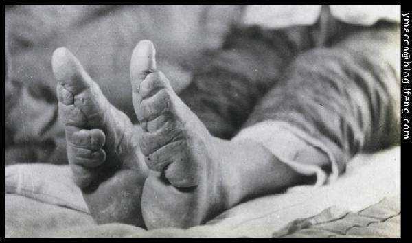 呵呵! 呵呵! 附一张缠足图,这可是中国