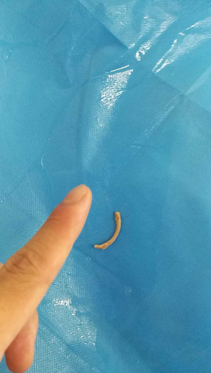 鸡骨头卡喉咙两个月,怎么被发现?