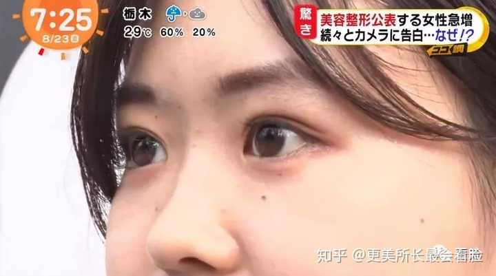 怎么才能去日本整容 知乎