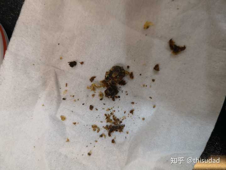 铁耳屎是怎么形成的图片