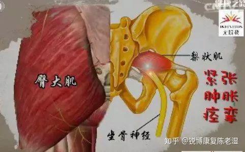 臀部肌肉解剖图ct图片