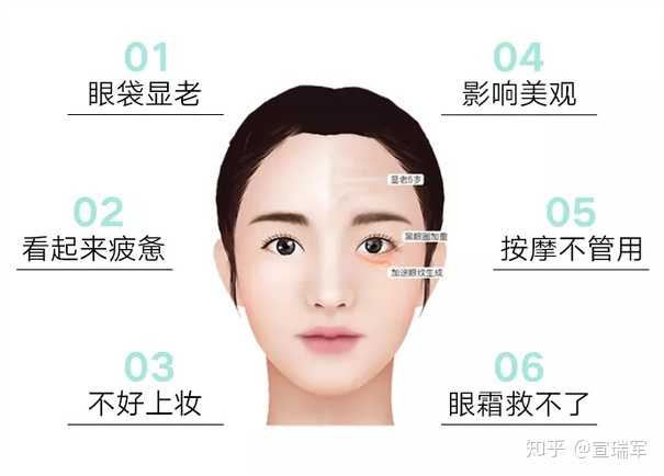 为什么会有眼袋 知乎 为什么会有眼袋 知乎