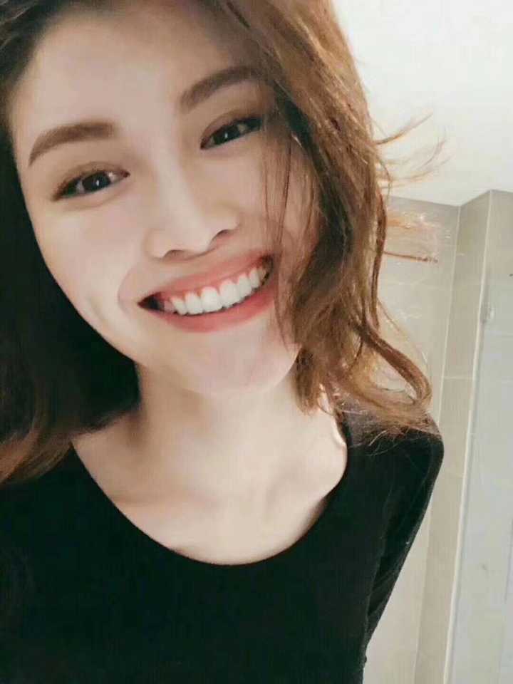 怎么才能像明星一样拥有一口大白牙?