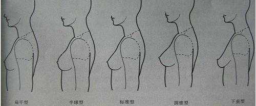 扁平型,或称作圆盘型.