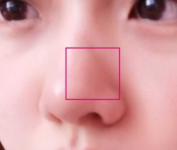 做过缩鼻头鼻翼的小仙女有什么感受吗 知乎 做过缩鼻头鼻翼的小仙女有什么感受吗 知乎