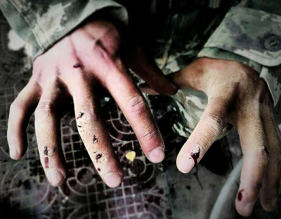 先上图好了. 一次考核完毕的小烂手. 好看吗?