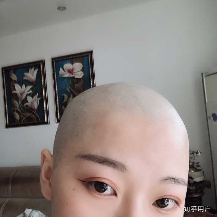 请问今年八月底剃个光头，明年三月出大概有多长，头发长长的速度恩就是正常人的速度剃光头能改善我的发质吗？ - 知乎