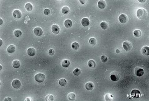 当牙釉质受损或者牙龈萎缩后,牙本质暴露,冷热酸等直接刺激到牙本质的