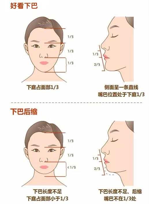 下巴没轮廓？