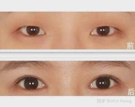 眼间距宽也很好看是一种什么样的体验？ - 知乎