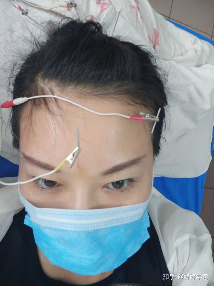 有没有眉骨疼痛 鼻骨疼痛的啊 知乎 有没有眉骨疼痛 鼻骨疼痛的啊 知乎