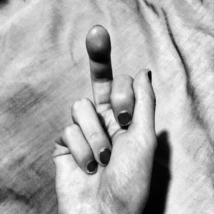 十指连心有多痛？