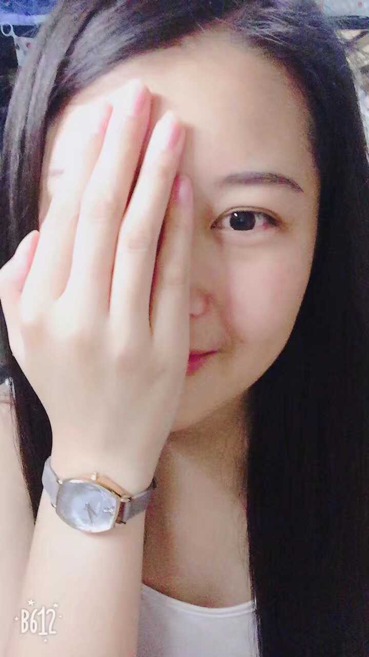 不过我拍照一般只拍左手,因为右手严重一点. 那就上图了