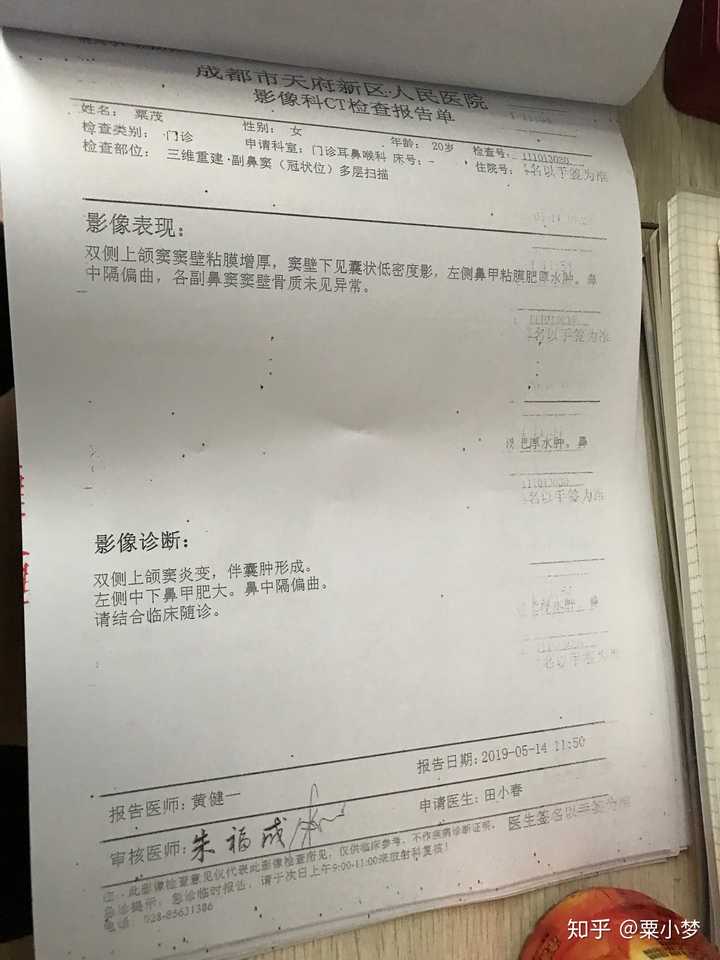 鼻中隔偏曲手术是一种怎样的体验 知乎