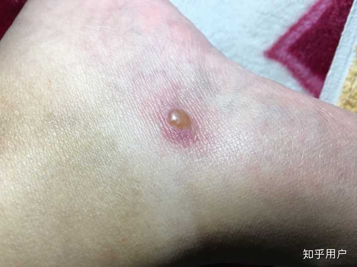 对自己的家乡水土不服是一种怎样的体验?
