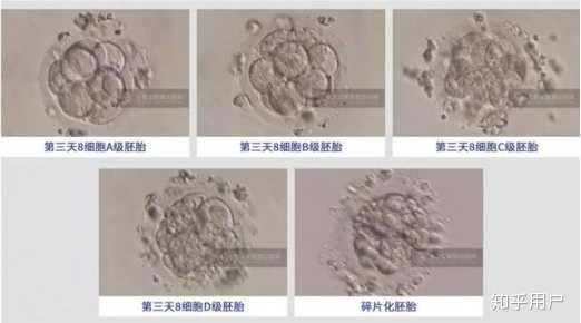 供卵试管前有必要做宫腔镜检查吗