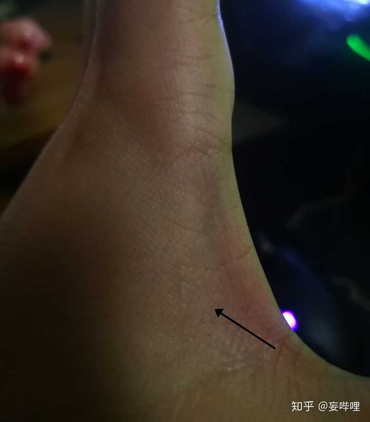 手套完全报废,指关节掉了块肉,虎口差点咬穿,胳膊上好几块淤青,顺着