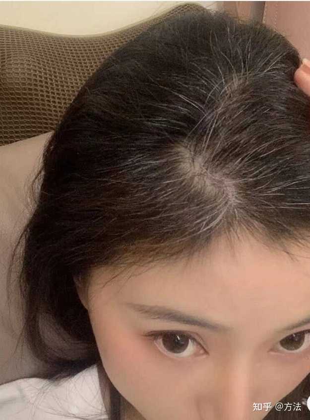 27岁已经有白头发有没有可能逆转 知乎 27岁已经有白头发有没有可能逆转 知乎