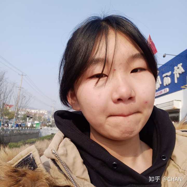 单眼皮小眼睛塌鼻梁大蒜鼻再加上皮肤差是什么体验?