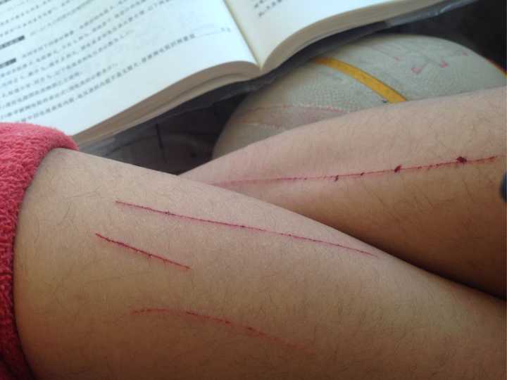 你被抑郁症折磨成什么样子了?