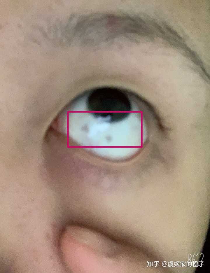 你见过什么特殊的胎记?