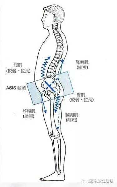 简单来说,骨盆前倾就是由于臀部和腹部较弱,而背部以及大腿前侧肌群