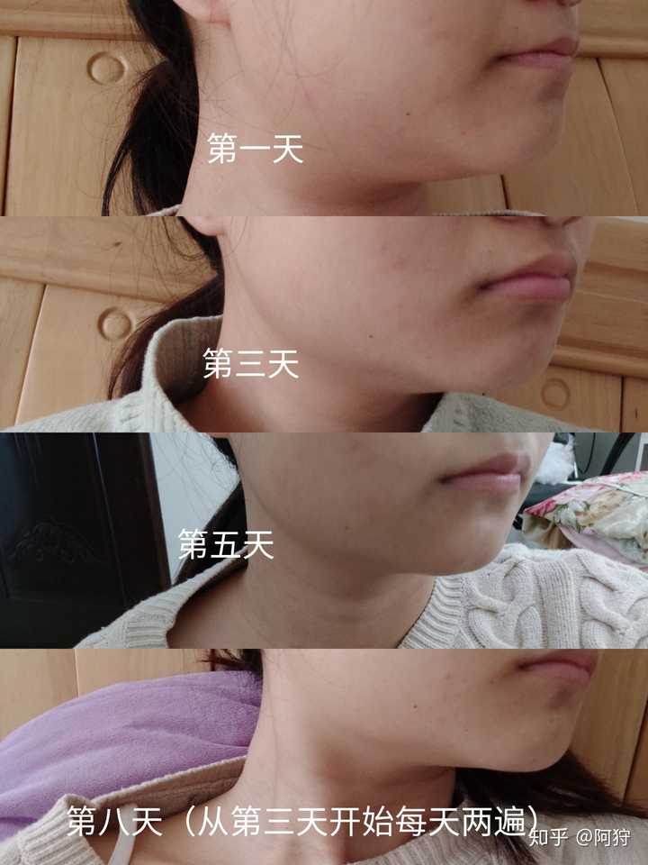 哈哈我要安利一下瘦不了猫那个瘦下颌线的教程了!真的超有用!