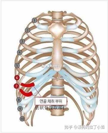异体肋软骨隆鼻可靠吗 知乎 异体肋软骨隆鼻可靠吗 知乎