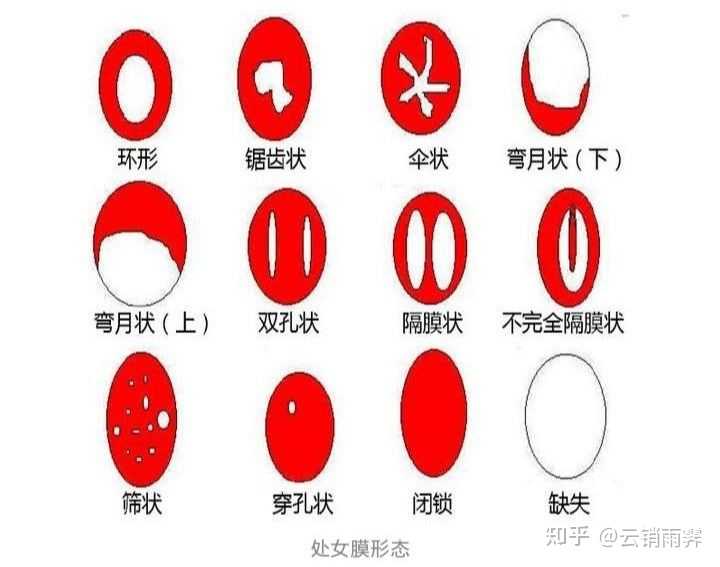 如何判断自己处女膜在或不在？