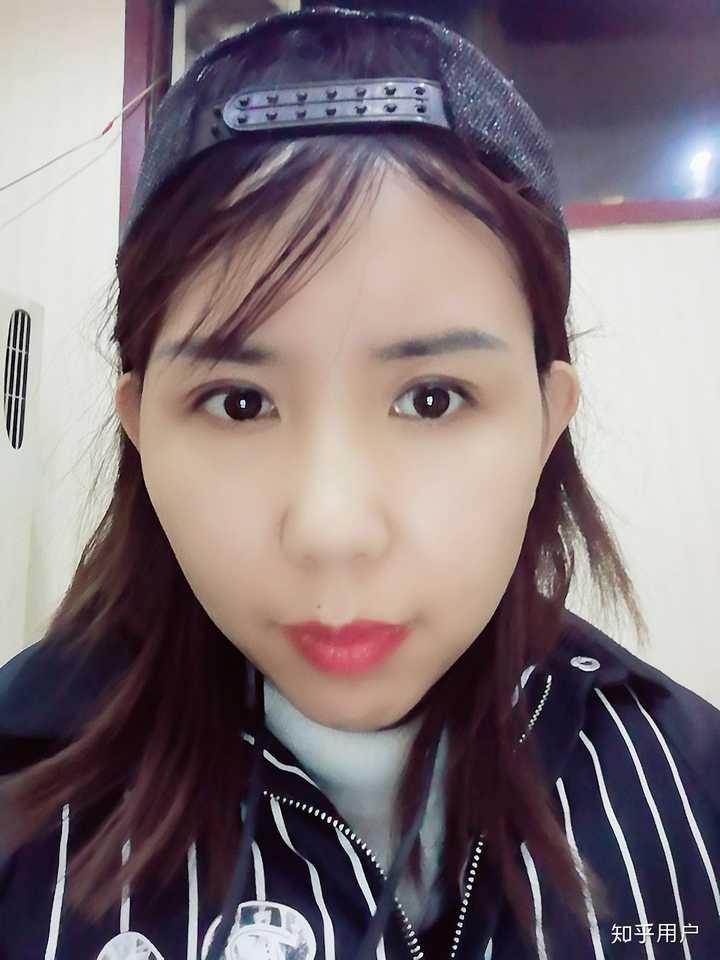 人中长显得又老又丑怎样能让人中变短缩短鼻子和嘴唇之间的距离