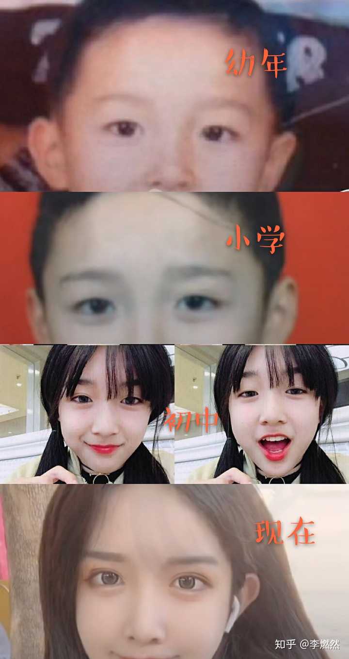 为什么整容一眼就能看出来 知乎 为什么整容一眼就能看出来 知乎