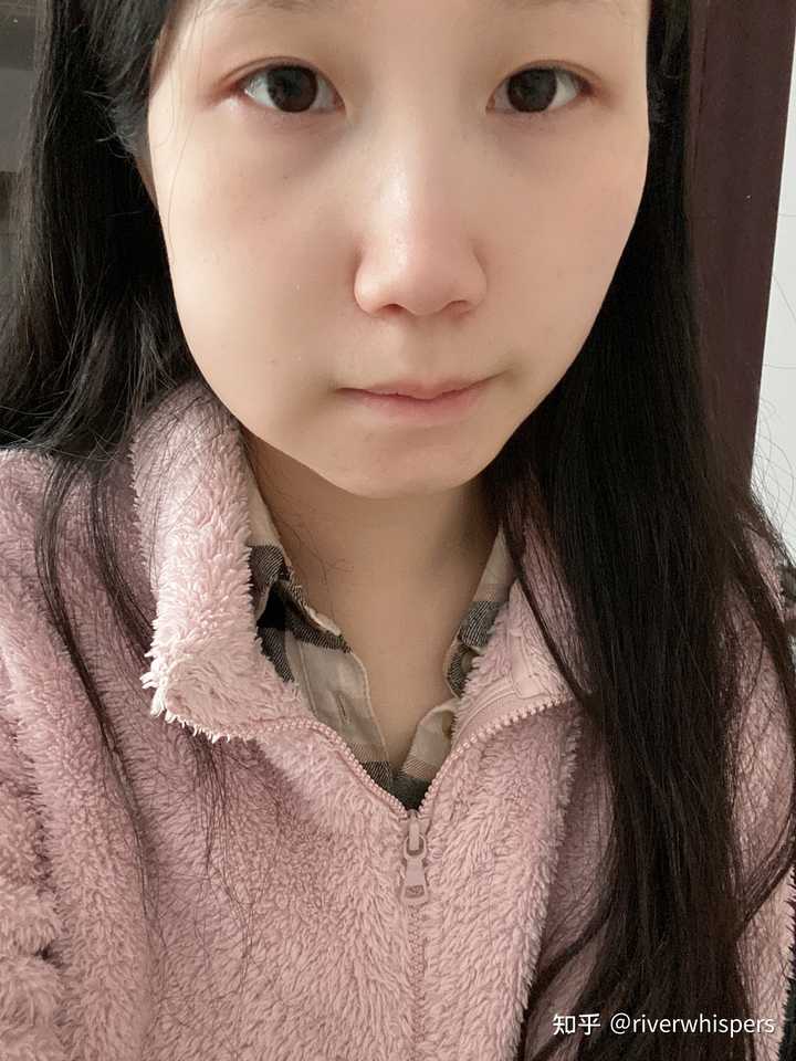 拔完智齿脸为什么会肿 知乎