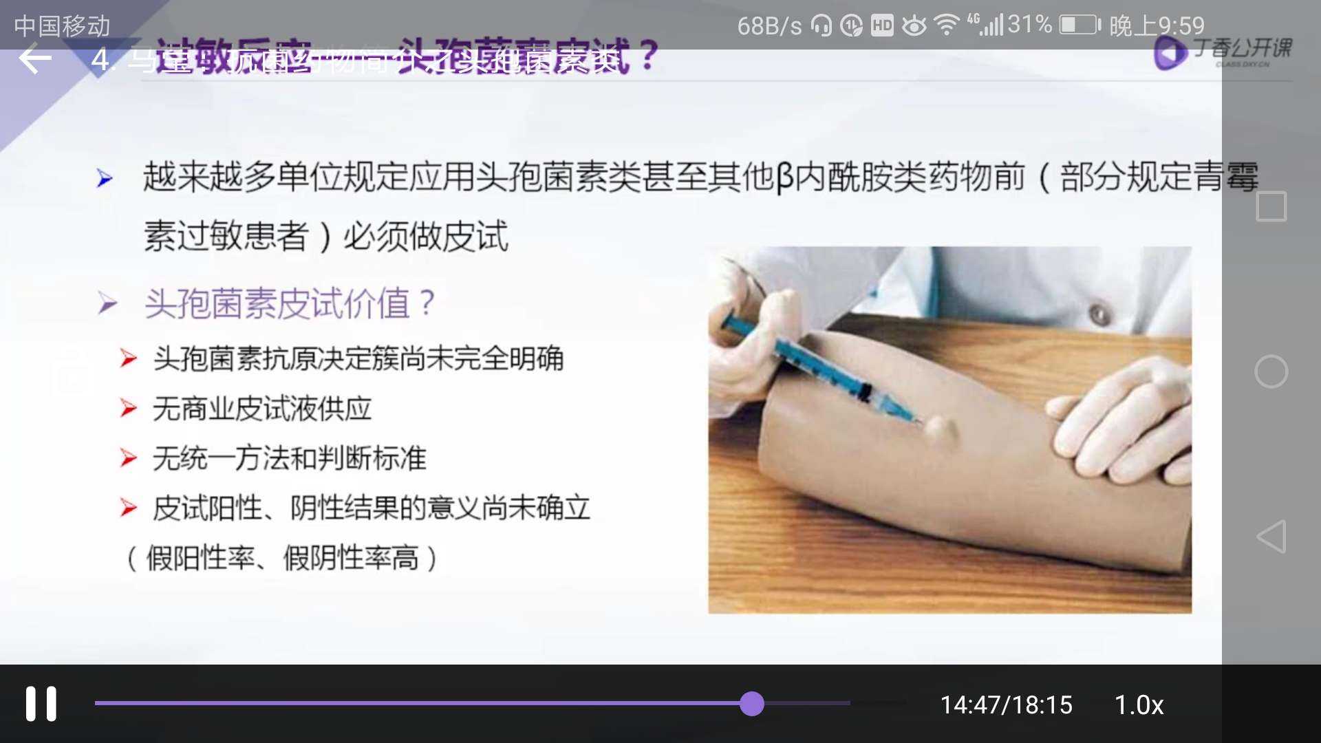 我真的是惊呆了,颠覆我对头孢的认知啦