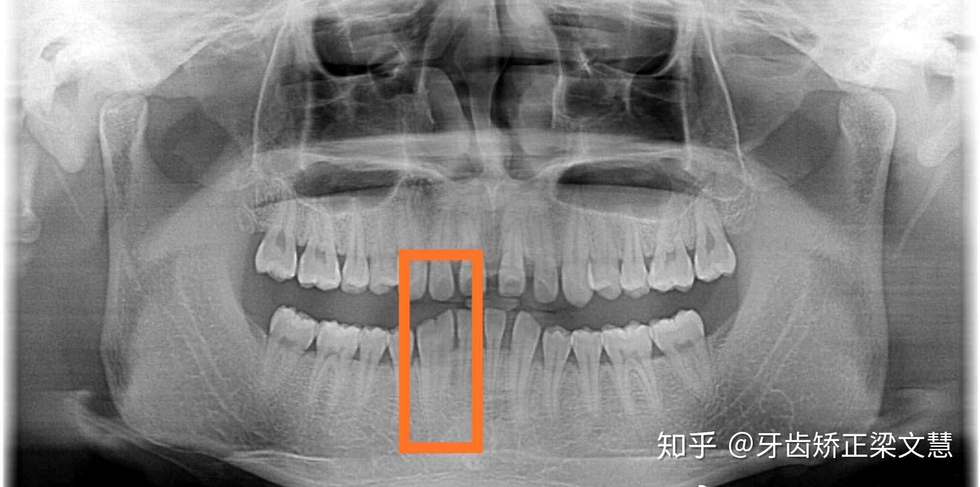 v2-9c90cc1289c048e146b9ff7fe73be008_r.jpg
