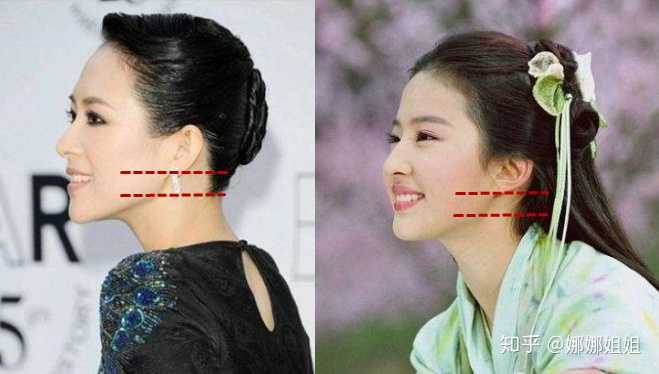 不整容怎么可以让国字脸变成爪子脸?