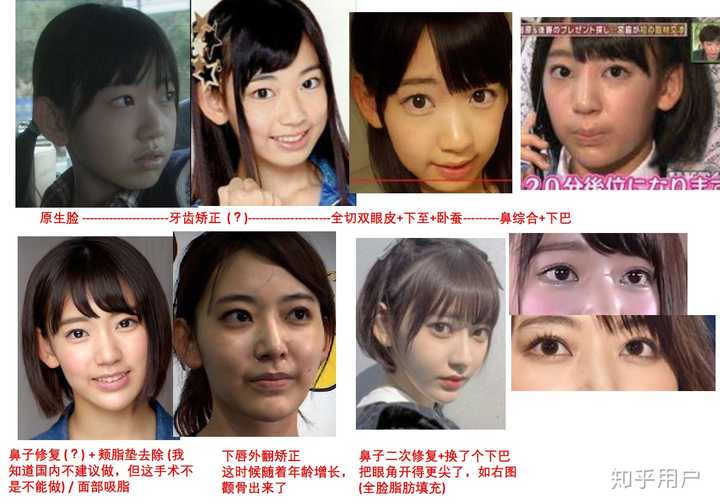 宫脇咲良到底有没有整容 匿名用户的回答 知乎