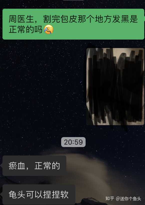 刚割完包皮是怎样的体验 知乎