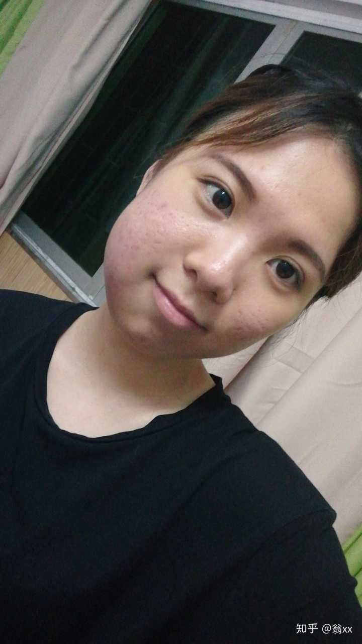 拔完智齿脸为什么会肿 知乎