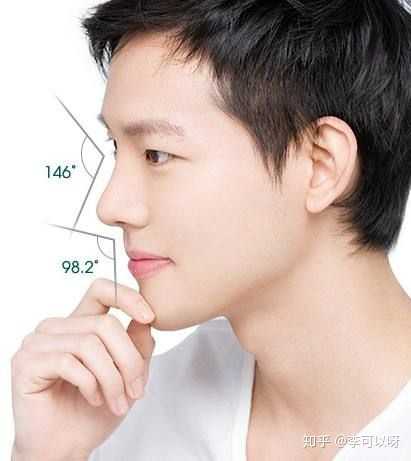 求问这种鼻子有什么问题?