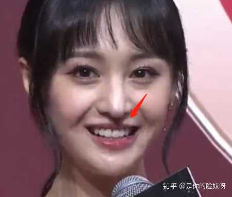 隆鼻会有什么后遗症吗 是你的脸妹呀的回答 知乎