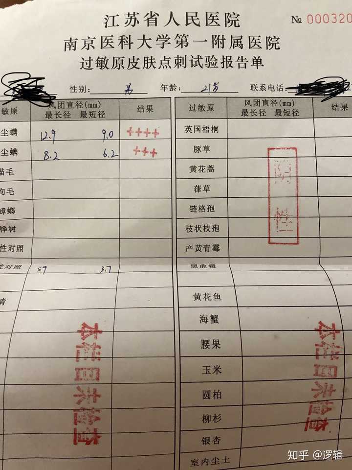 查过敏源需多少钱 知乎