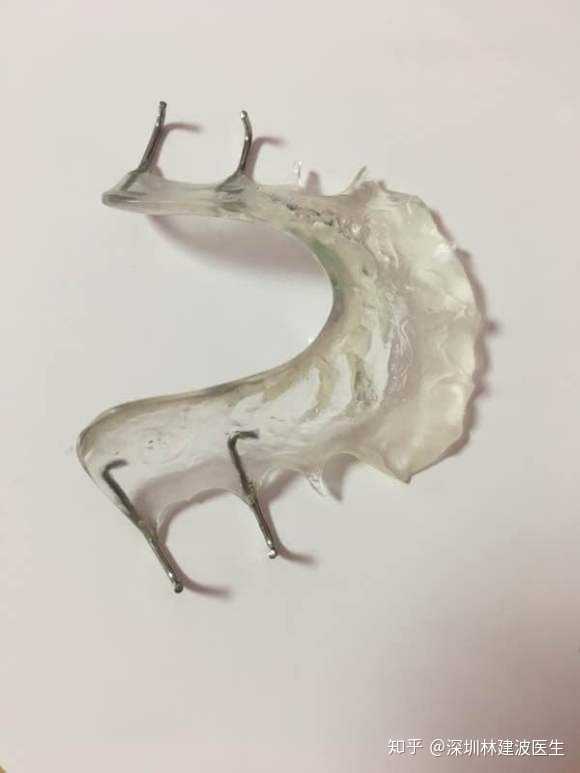 请问大家戴了平导之后除了脸变长之外脸会变瘦嘛还是会宽?