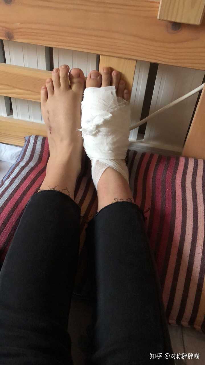 女生脚丑是种什么样的体验 知乎 女生脚丑是种什么样的体验 知乎