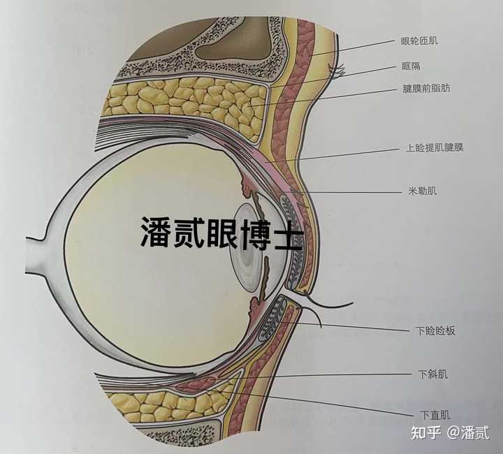 请问下三白眼如何改善呢? - 知乎