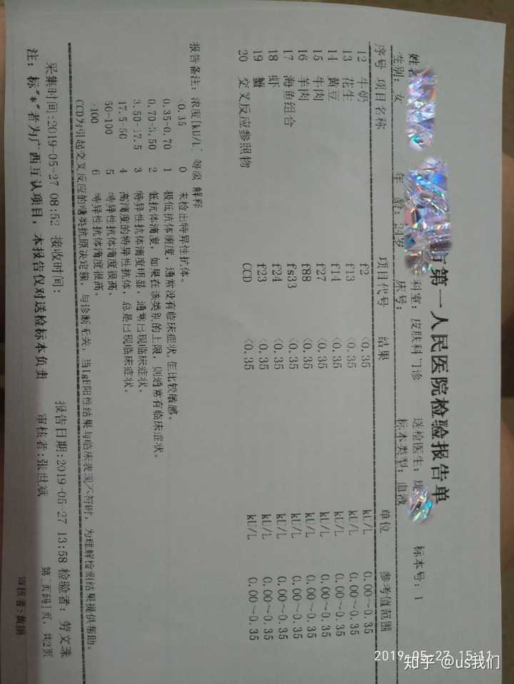 大家做过过敏原测试么 都有哪些 我可以带着我怀疑的过敏原去测试么 知乎 大家做过过敏原测试么 都有哪些 我可以带着我怀疑的过敏原去测试么 知乎