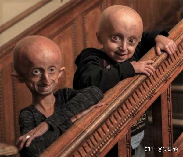 又比如说,遗传物质的异常,还会加速衰老的进程.