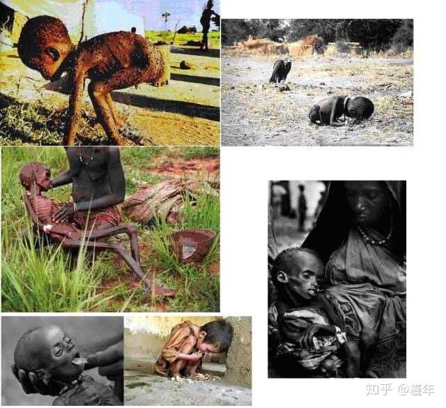非洲儿童饥饿现状图片
