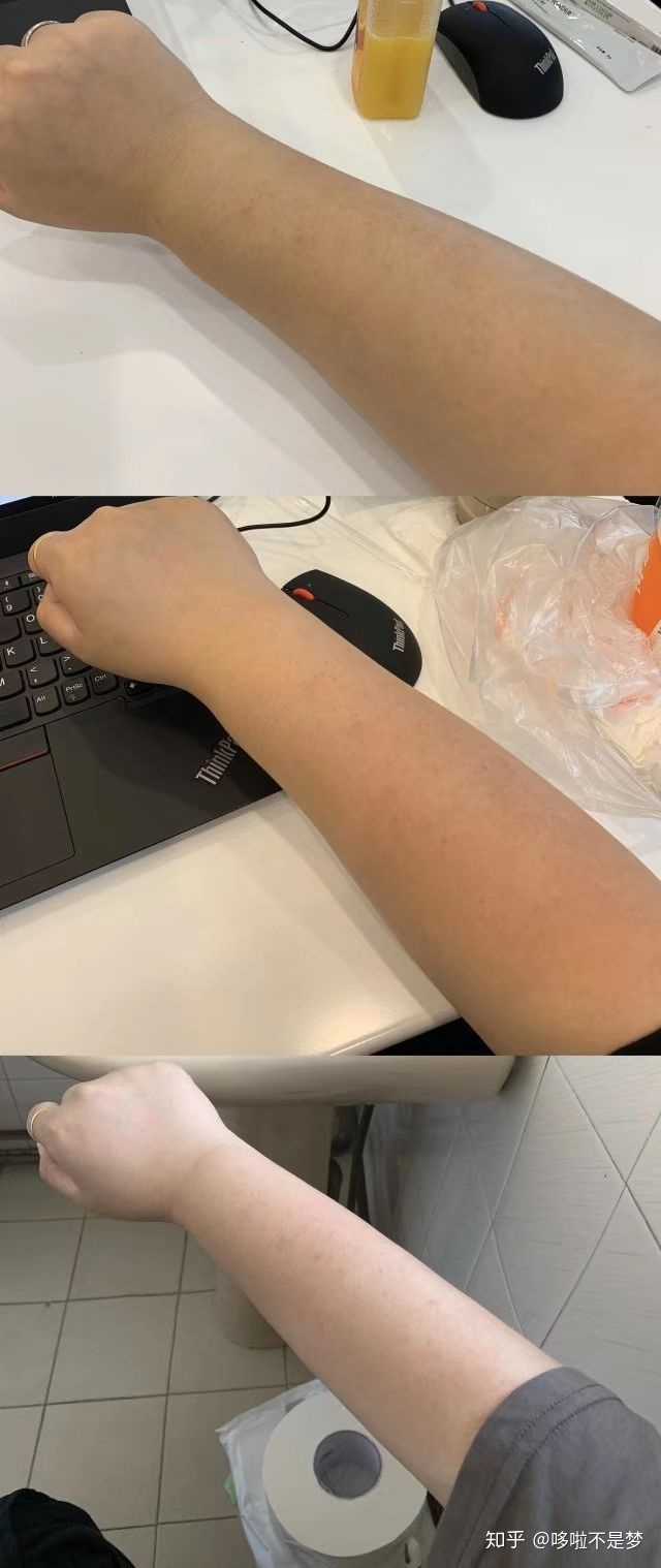 从小皮肤很白.为什么越来越黑?