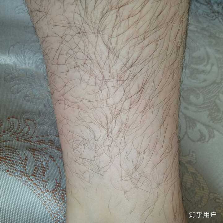 男生看到有腿毛的女生是什么感受?