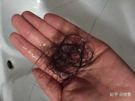 一个一天掉多少头发是正常的